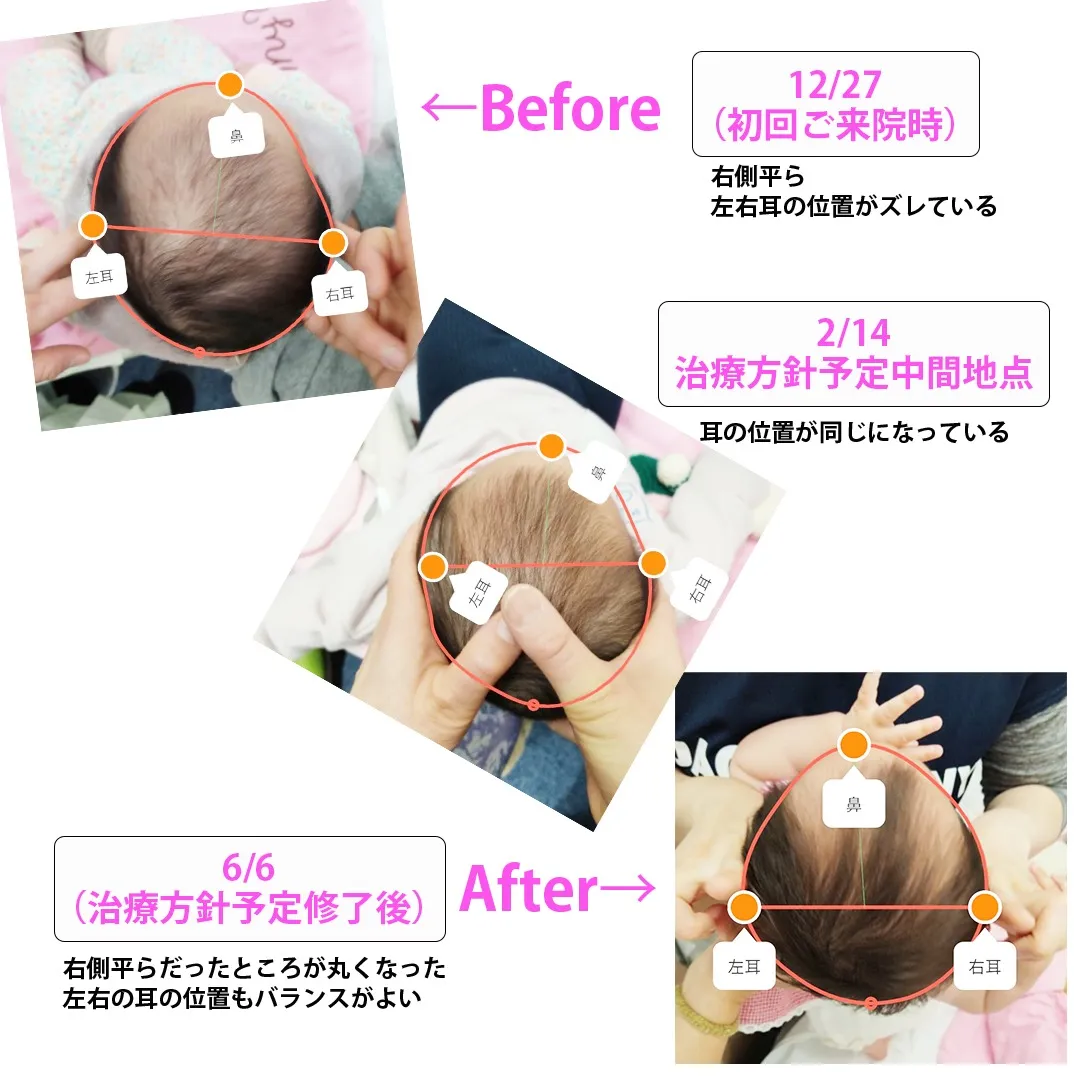 【赤ちゃんケア整体もやっています】&【ベビーマッサージセラピ赤ちゃん整体】